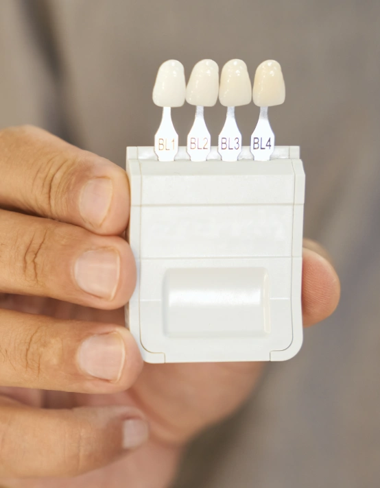 Custom porcelain veneers designed for a natural-looking smile