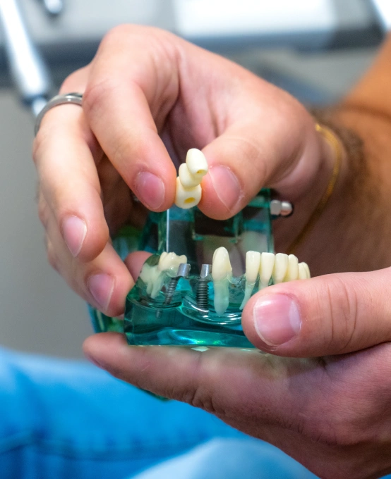 A Permanent Solution to Tooth Loss